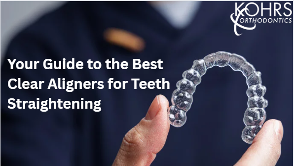 Best Clear Aligners