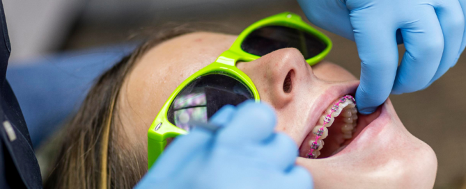 Orthodontist wearing blue gloves adjusting a young patient’s pink braces while the patient wears green protective glasses in a dental office, showing keeping your braces clean, representing keeping your braces clean