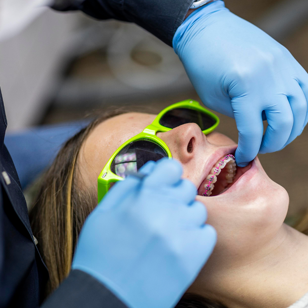 Orthodontist wearing blue gloves adjusting a young patient’s pink braces while the patient wears green protective glasses in a dental office, showing keeping your braces clean, representing keeping your braces clean