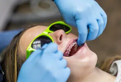 Braces for kids 3 Child receiving dental treatment with braces, representing braces for kids