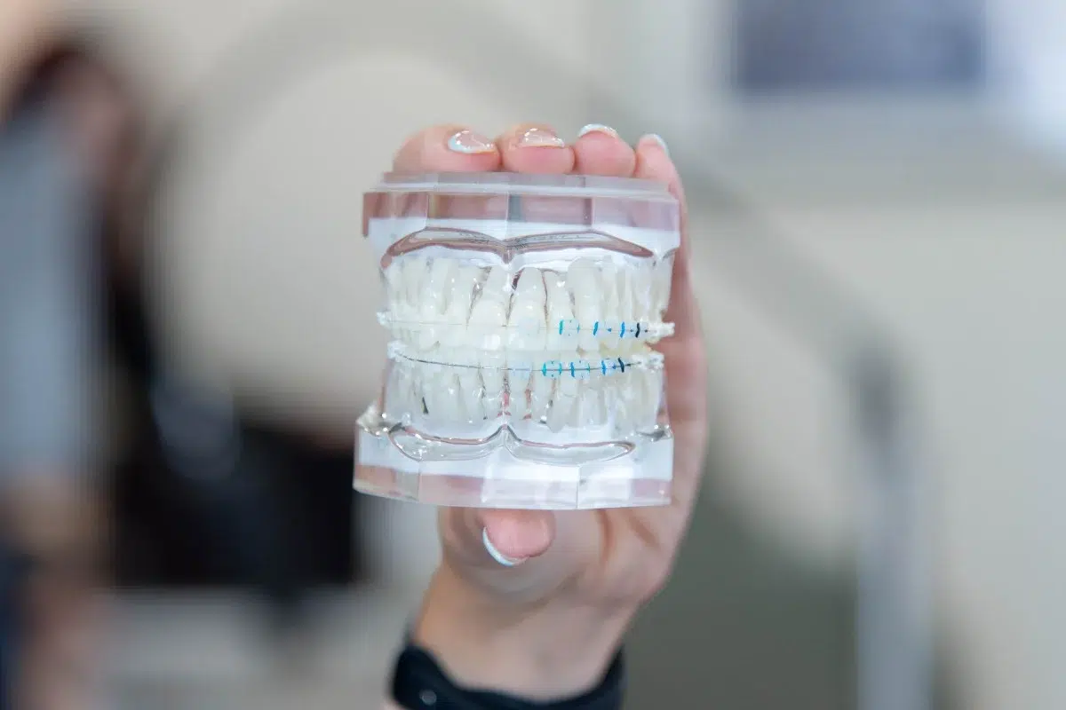 Kohrs-orthodontics-clear-braces Clear braces model at kohrs orthodontics in aurora, bennett, and strasburg, co, showing discreet orthodontic treatment from an expert, top-rated metro denver orthodontist
